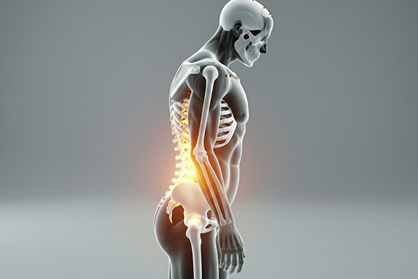 Lordosis (Lumbar Spine Curvature)