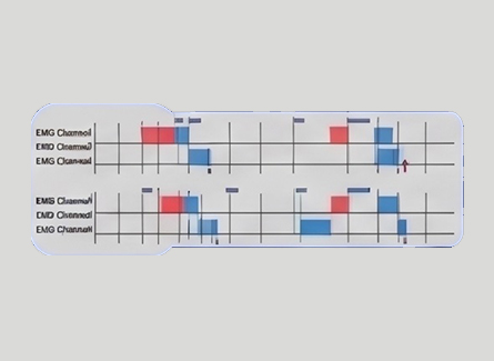 Automatic patient identification (PhysioID)
